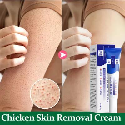 10% Urea Vitamin E Body Cream Moisturizing Hand Lotion for Dry Skin Keratosis Pilaris Treatment