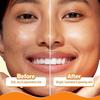 Aqualogica Glow+ 30X* Serum nawilżające z witaminą C — 50 ml | Rozjaśnia skórę I Moc 30X* Witamina CI Lekki i nieklejący się