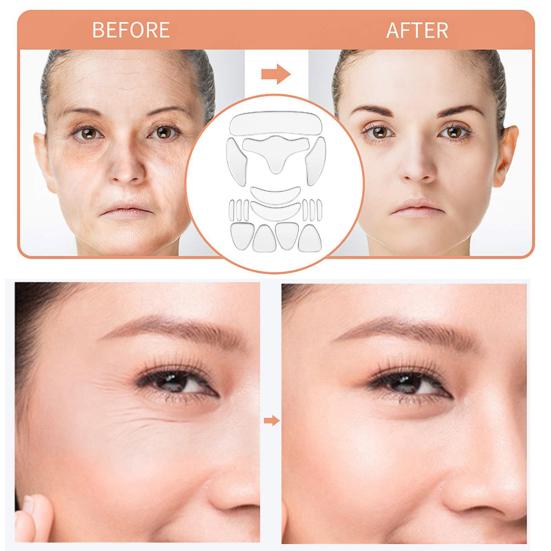 1 sett Anti-rynkeplaster for ansikt pannen Gjenbrukbare silikonlapper Over natten ansiktsplaster for å glatte ut rynker Kråkeføtter Hypoallergenisk