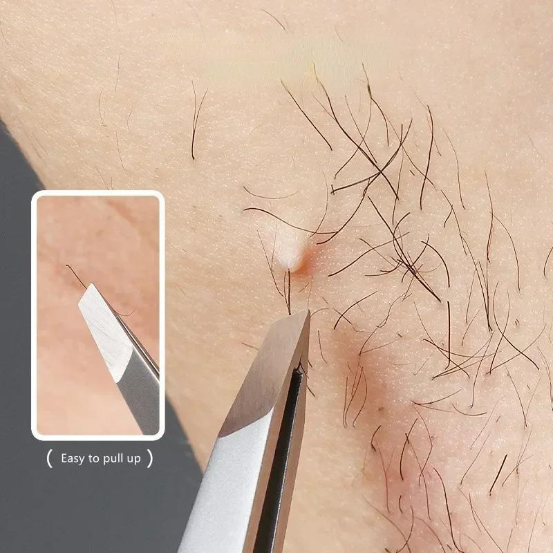 1 st Ögonbrynspincett i rostfritt stål för män och kvinnor, pincett med hög precision, cellklämma med hög precision, pormärkesklämma