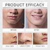 Men's Moisturizing Face Cream Nourishes The Skin, Reduces Wrinkles And Fine Lines, Stimulates Collagen And Revitalizes The Skin.