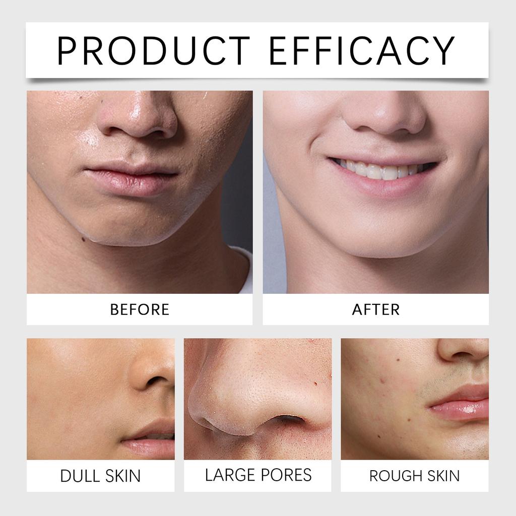 Men's Moisturizing Face Cream Nourishes The Skin, Reduces Wrinkles And Fine Lines, Stimulates Collagen And Revitalizes The Skin.