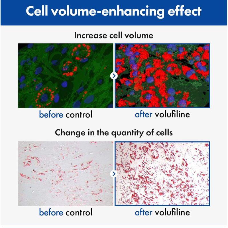 TOSOWOONG Volufiline 100% Botanic Oil