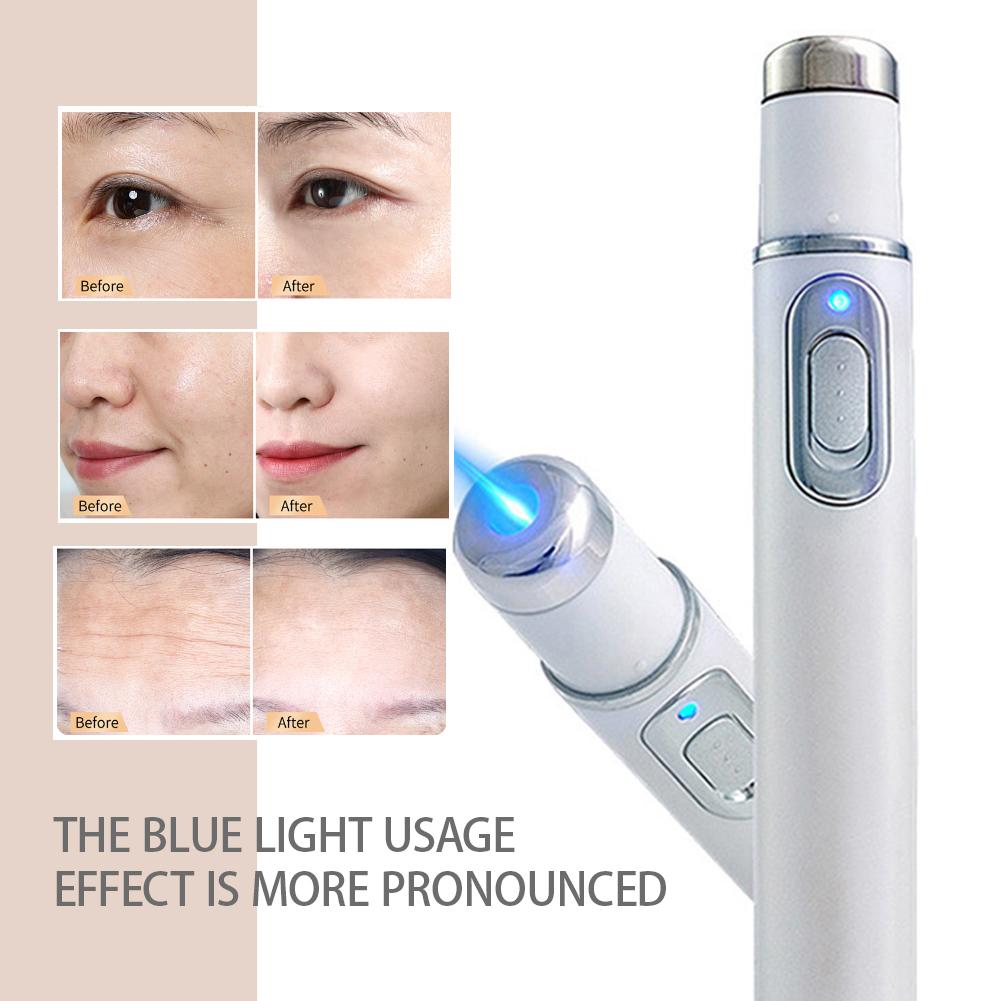 Blue Light Acne Pen Heated Eye Massager Eye Massage Instrument for Dark Circles Eye Bags Puffiness Under Eyes Beauty Pen