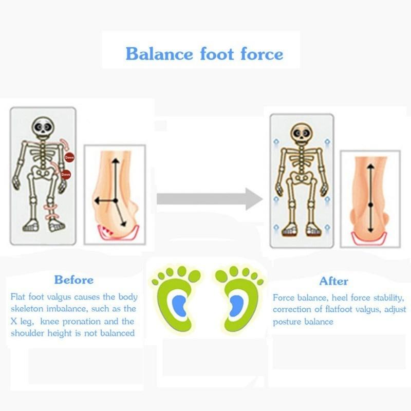 Kids Gel Orthotic Orthopedic Insoles for Children Shoes Flatfoot Corrector Arch Support Orthotic Pad