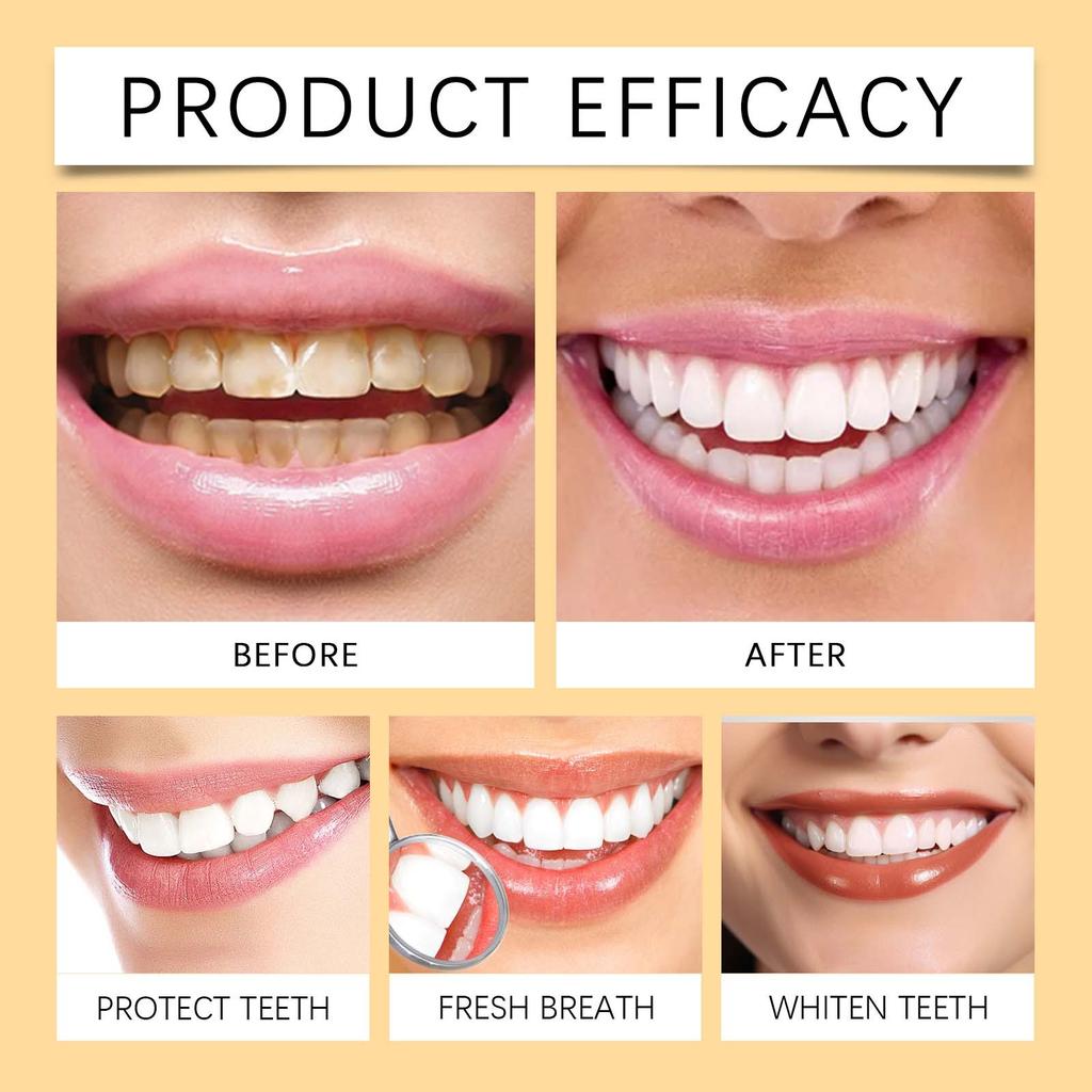Zahnaufhellungsstift Reduziert Verfärbungen, Hellt auf und Schützt den Zahnschmelz. Tragbarer Mundpflege-Aufhellstift, 2 ml