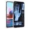 Transparent Phone Case for Redmi 14C 13C 10C 10 9 Note 13 12 11 K50 K40 Plus Pro 4G 5G Soft TPU Cover Autumu X Ray Hand Bones