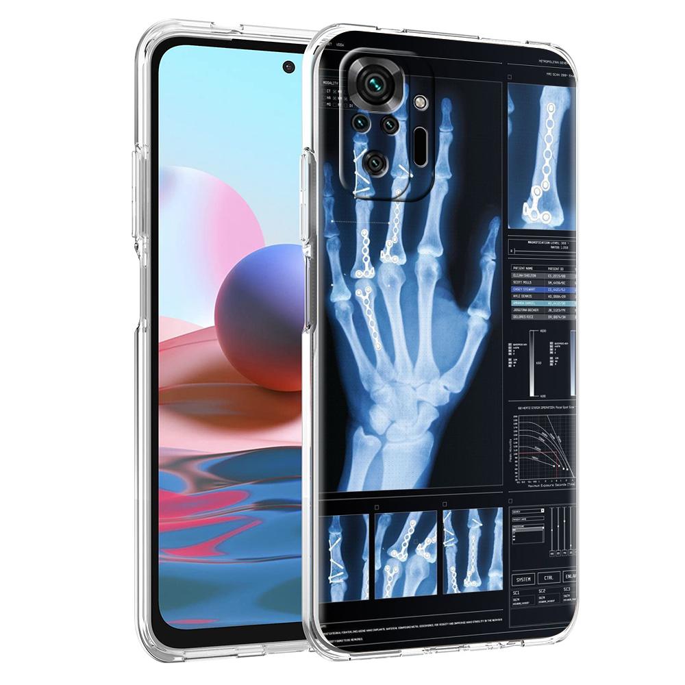 Transparent Phone Case for Redmi 14C 13C 10C 10 9 Note 13 12 11 K50 K40 Plus Pro 4G 5G Soft TPU Cover Autumu X Ray Hand Bones