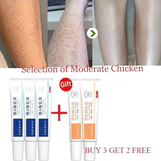 Body Whitening Cream Keratosis Pilaris Treatment Bumpy Rough Chicken Follicle Skin Repair Strawberry Legs Removal Dry Skin Care