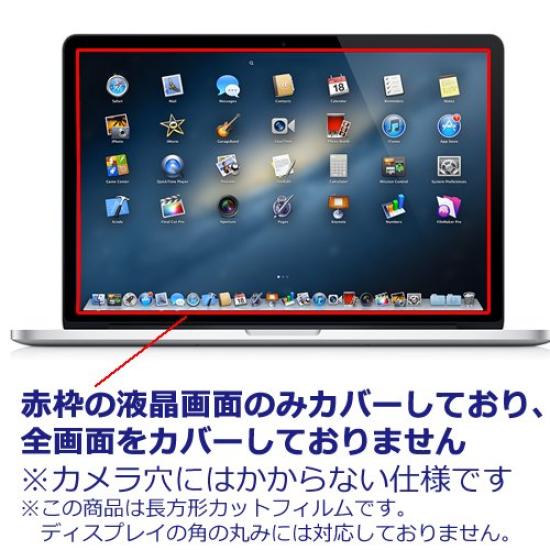 Media Cover Market Compatible with HP ENVY Inch Model Set of Notebook PC Clear Glossy LCD Protective and Silicone Keyboard 15-as100 [15.6 (1920x1080)]