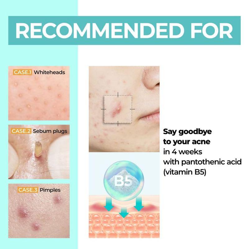 numbuzin - No.1 Pantothenic B5 Active Soothing Cream