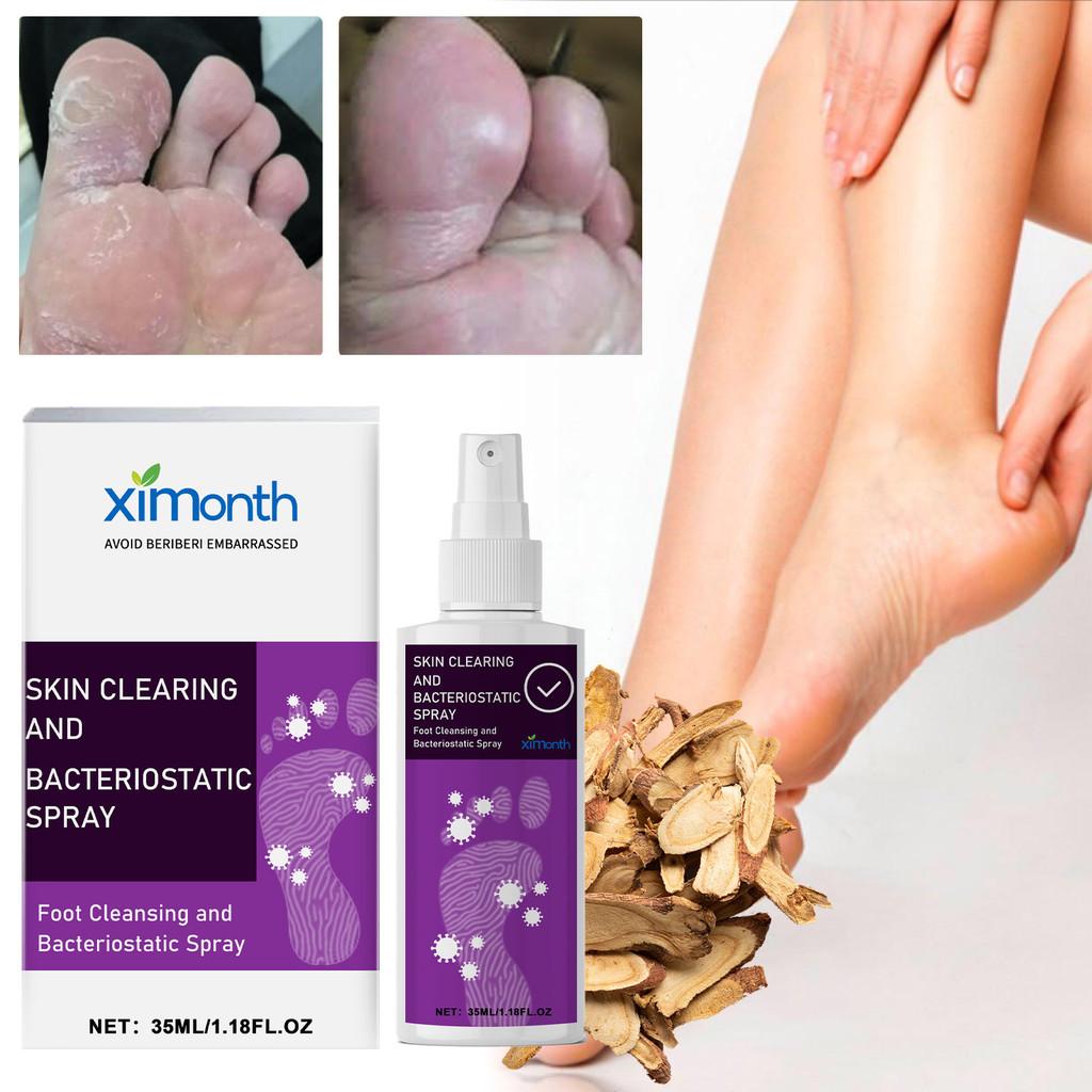 Ximonth Foot Care Spray Refreshing Odor Eliminating Formula For Sweaty Feet And Itch Relief