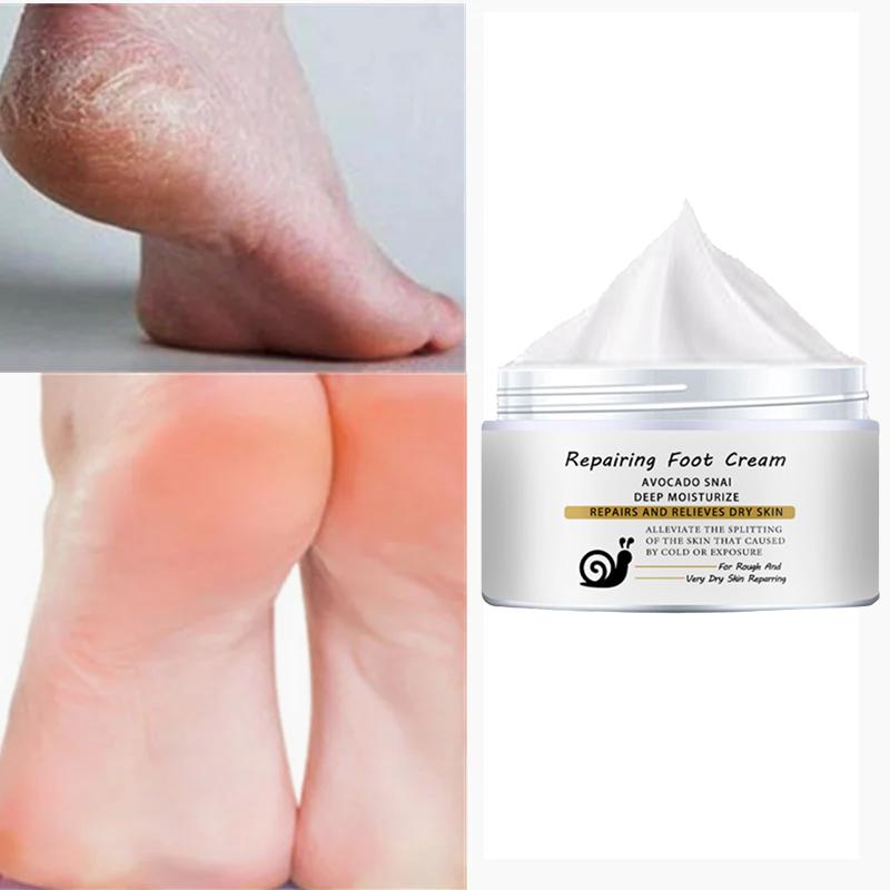 Repair Foot Cream for chapped, broken hands/heels, natural essence cream, gentle and non-irritating