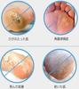 Generic Brands Heel Callus Foot Stainless Steel for Safe and Effective Callus Suitable for Dry and Wet Heel Care Remover, Exfoliator, Micro-Cutter