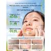 Teen Acne-Clearing Facial Cleanser
