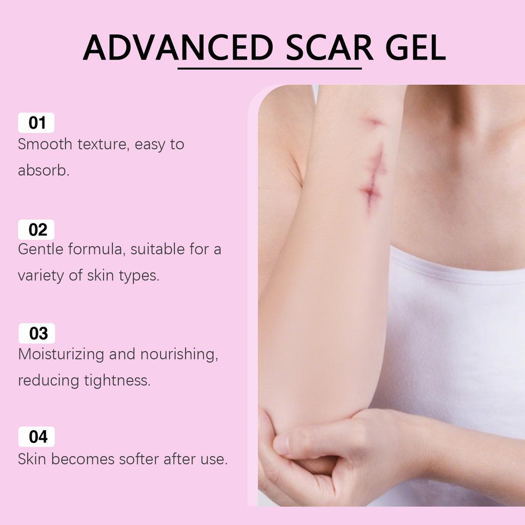 Silicone Scar Gel And Scar Cream Can Fade Uneven Skin Tone, Dullness, Burn And Scald Scar. Suitable For All Skin Types