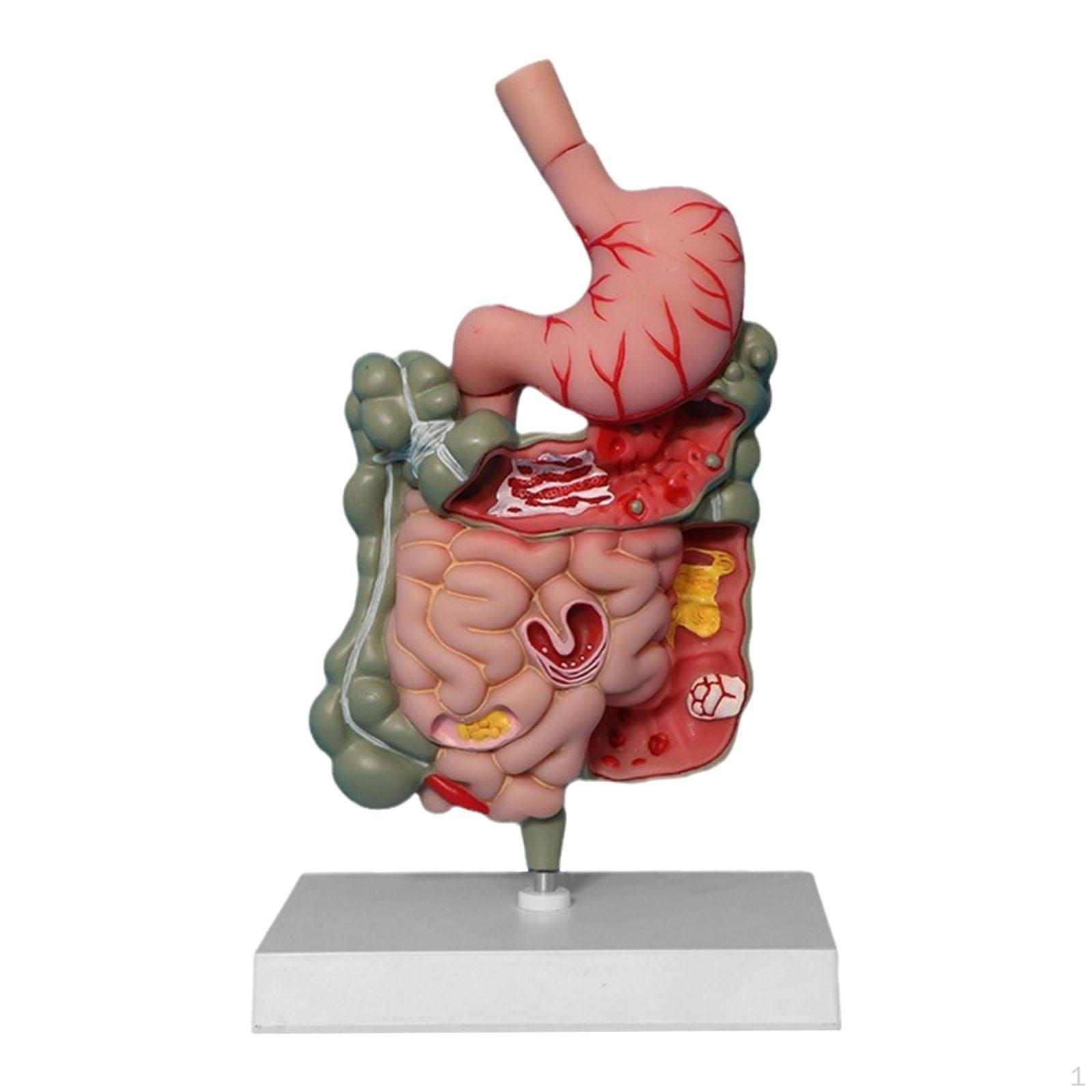 Human Digestive System Model,Teaching Aids PVC Professional Rectum Duodenum Model Stomach Section