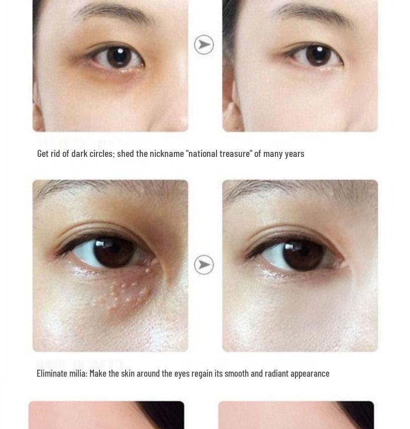 Anti-Wrinkle Eye Cream: Reduces Fine Lines, Bags, Tear Troughs & Crow's Feet; Moisturizes, Fades Dark Circles, Lifts & Firms