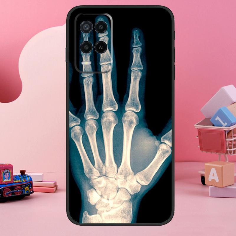 

Skeleton Art Case For Oppo A18 A38 A58 A78 A98 A74 A54 A94 A80 A60 A40 A96 A76 A16 A15 A17 A57 A77 A5 Pro OPPO A94 4G