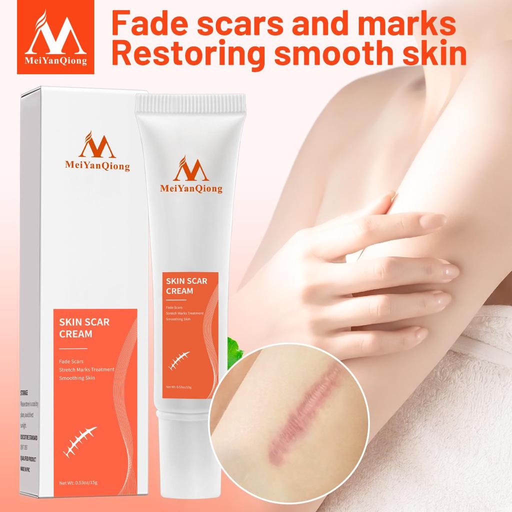 Acne Removal Cream Skin Repair Face Cream Acne Spots Acne Blackhead Whitening Cream