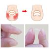 Toenail Correction Set Toenail Treatment Toenail Straightening Patch Lifter Fixer Recover
