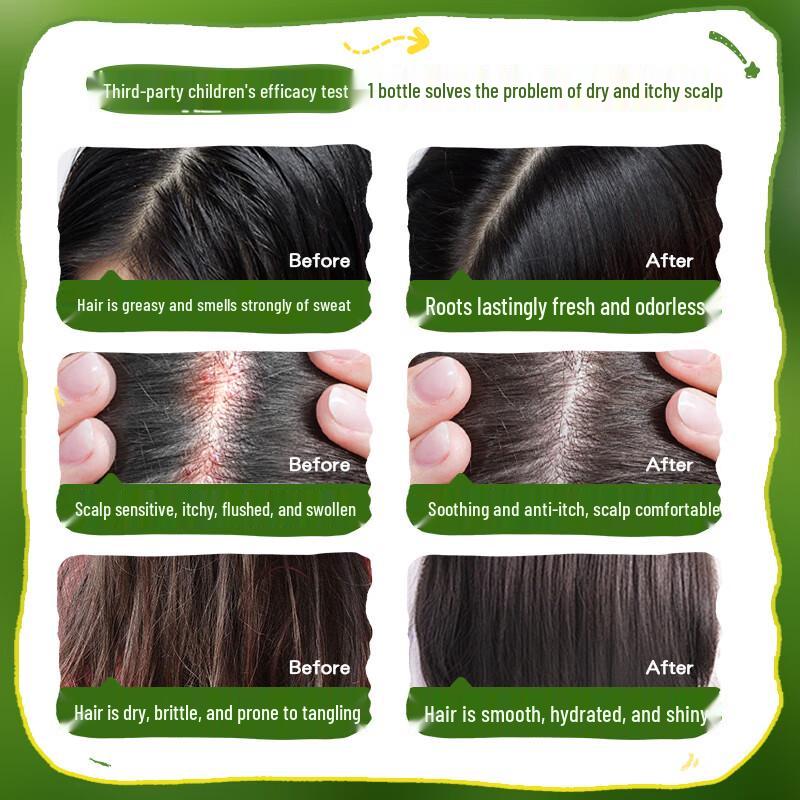 RUYI Gentle Kids' Anti-Dandruff & Oil Control Shampoo