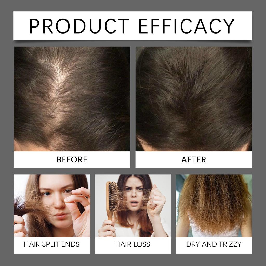 AMZ Hair Care Serum Gentle Nourishing Replenishing Strengthening Volumizing Daily Scalp Care Essence
