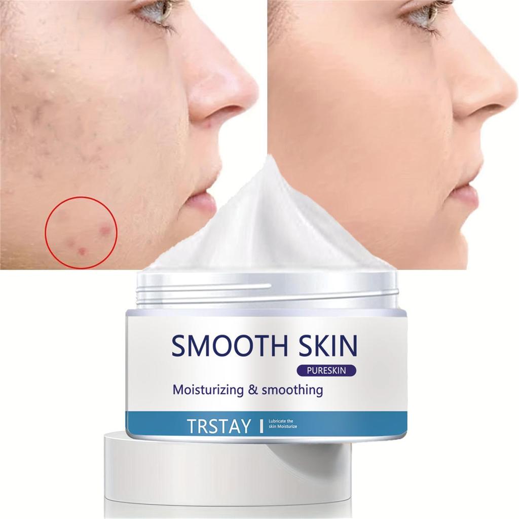 Whitening and Acne Removing Essence Cream, Brightening Facial Skin, Anti-oxidation and Anti-aging, Moisturizing Cream