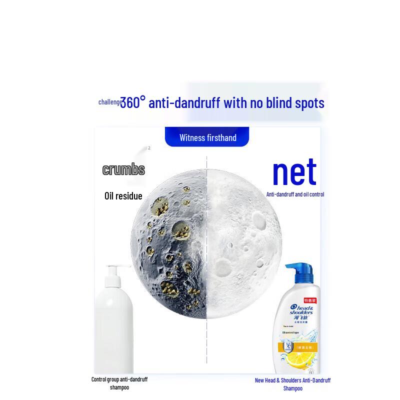 Head & Shoulders Anti-Dandruff Refreshing Oil Control Shampoo