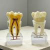 Dental Nerve Model - Tooth Structure Display, Cross-section Analysis, 6x Magnification for Oral Teaching