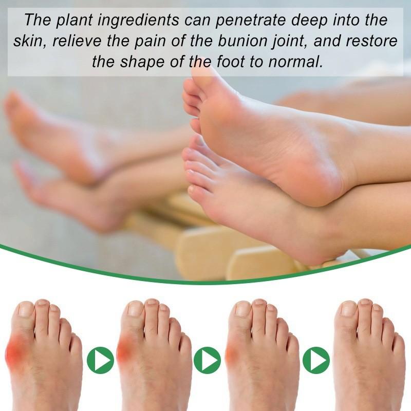 Ximonth Premium Soft Gel Pads For Gentle Relief Of Foot Pain And Discomfort