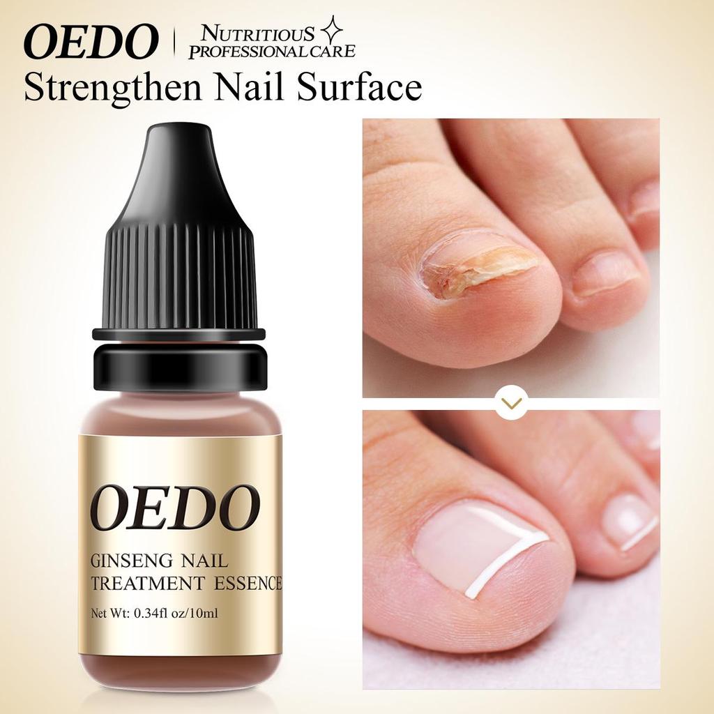 OEDO Nail Repair Treatment Ginseng Nail Essential Oil Nail Art & Tools Healthy Nail Treatment Foot Care