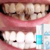 Le dentifrice à l'acide hyaluronique HA5 élimine efficacement les taches et les taches sur les dents.; Éclaircir les dents Renforce, protège et blanchit les dents sensibles
