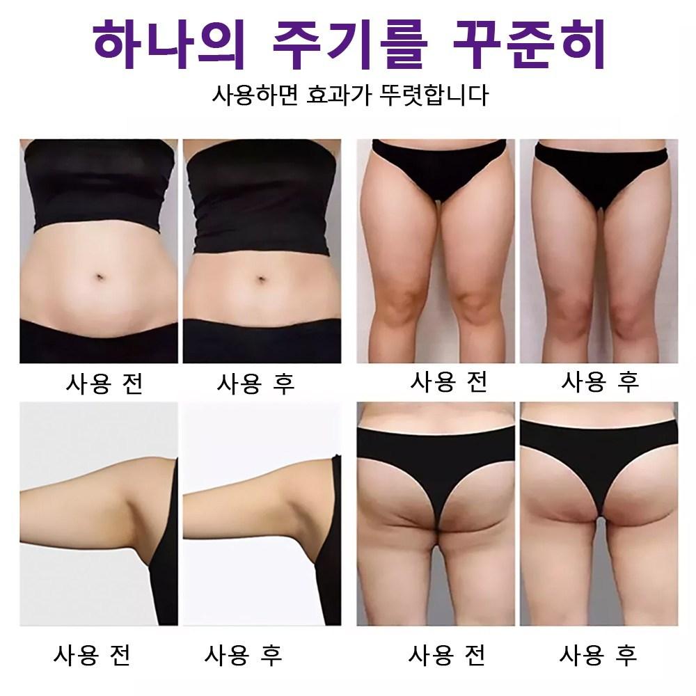 Body Diet Patch, Calf and Forearm Patch, for All Areas, Slimming, Fat Burning, Obesity Management Help, 1 Piece, 18 Pieces