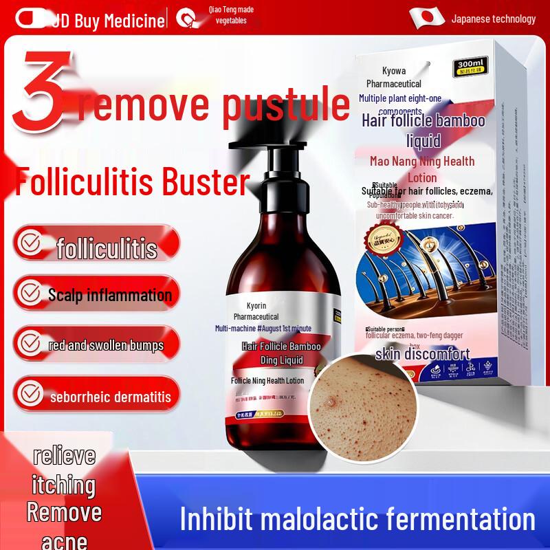 Qiaoteng Folliculitis & Antifungal Scalp Shampoo