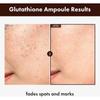 [NEU] TOSOWOONG Glutathion Ampulle, 30 ml