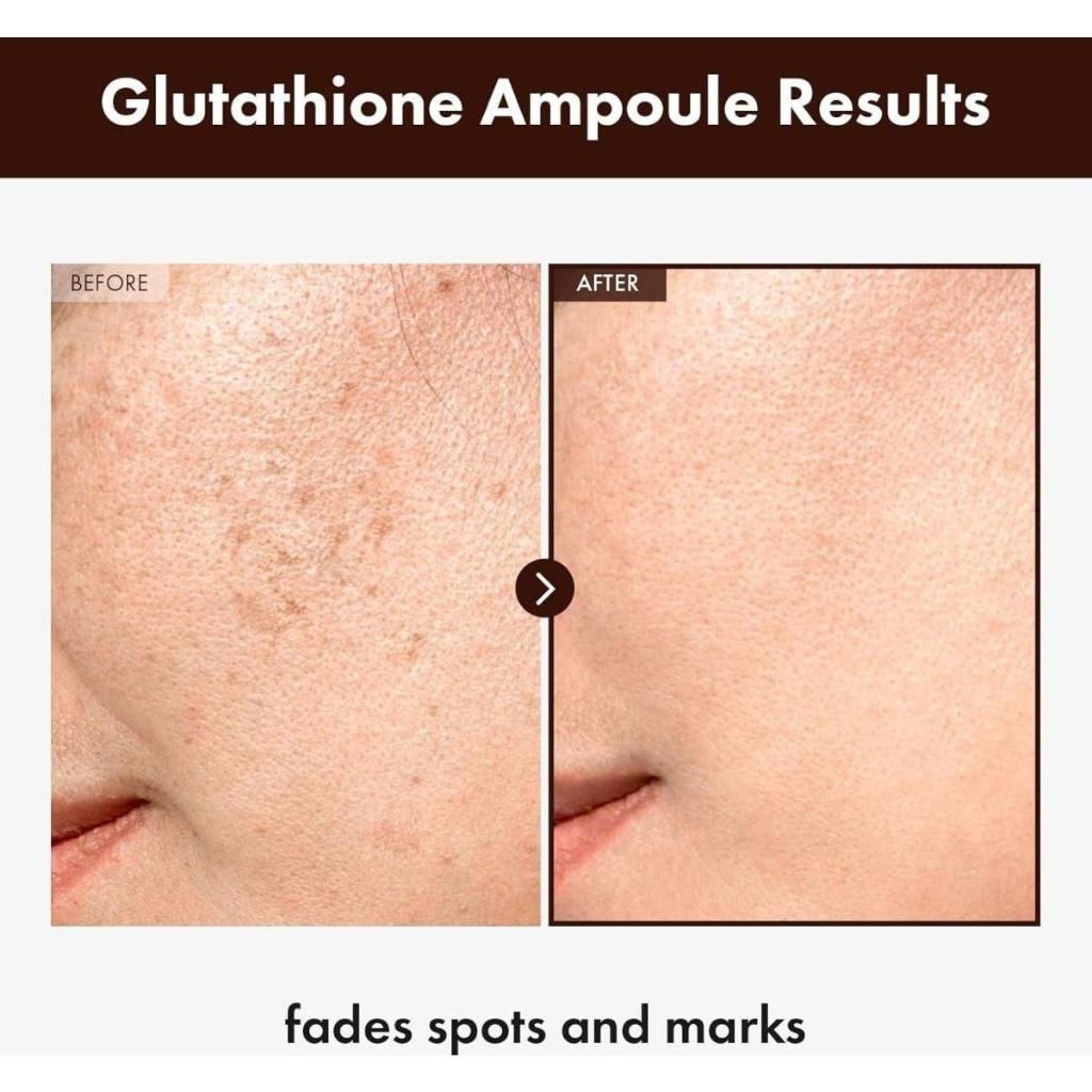 [NEU] TOSOWOONG Glutathion Ampulle, 30 ml
