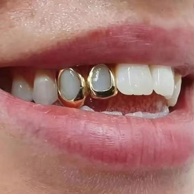 Grillz dentaires géométriques creux brillants de style punk tendance Europe et Amérique