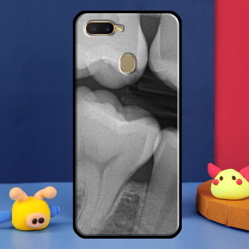 Dentist Dental Dent Tooth For Oppo A54 A57 S A78 A58 A98 A5 A9 A91 A15 A16 A17 A52 A72 A76 A96 A74 A94 A77 Phone Case