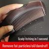 Portable Anti-Dandruff & Anti-Itch Massage Comb - Wash-Free & Oil-Removing, Pressable Design
