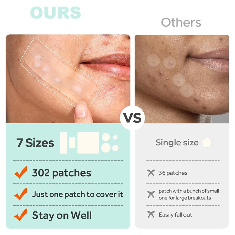 

302 шт. Пластыри от акне Восстановление акне Очищение Невидимые Дышащие Водонепроницаемые Акне