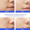 HydraFacial Skincare Face Serum Hydro Facial Aqua Peel Solution 400ml AS1 SA2 AO3 For Hydrafacial Machine Skin Deep Cleaning