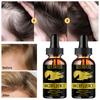 5ML/15ML/30ML/50ML/sérum de croissance des cheveux produit de soin des cheveux sérum capillaire cheveux rapides