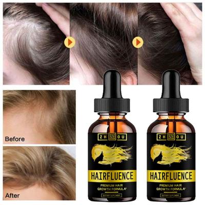 5ML/15ML/30ML/50ML/Haarwachstumsserum Haarpflegeprodukt Haarserum Schnelles Haar
