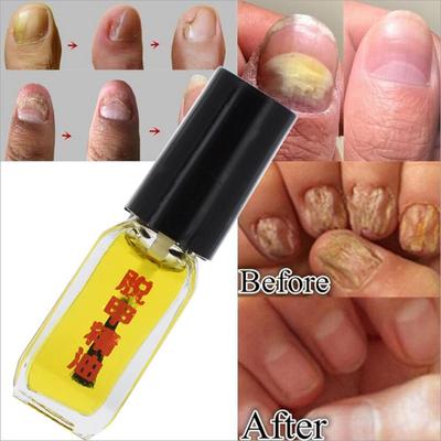 Neue 5 Tage Effekt Nagelpflege