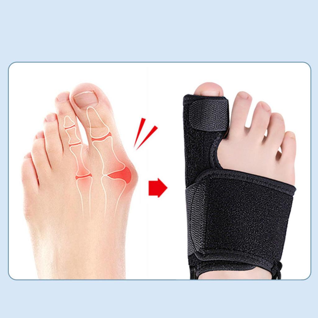 Toe Corrector Orthotics Bone Thumb Adjuster Hammer Protector Hallux Valgus Brace Bunion Corrector Orthopedic Tool Care Tools