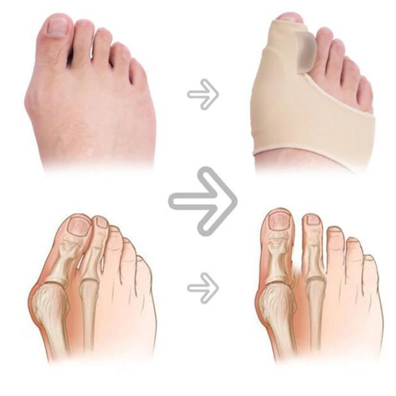 1Pair Toe Separator Hallux Valgus Bunion Corrector Orthotics Feet Bone Thumb Adjuster Correction Pedicure Sock Straightener