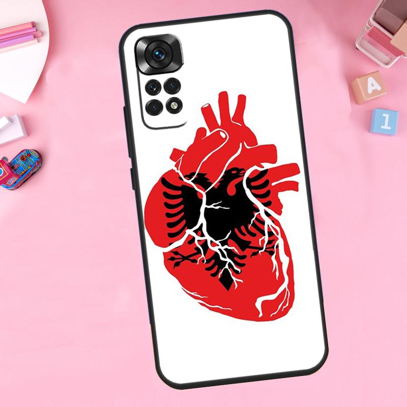 Albania Flag For Xiaomi Redmi Note 14 10 11 12 13 15 Pro Plus Phone Case For Redmi 15 15C 14C 12C 10C 13C