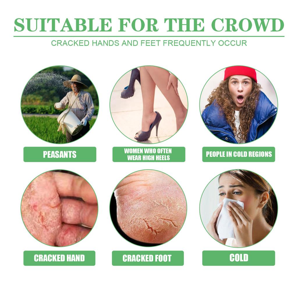 EELHOE Krem do stóp przeciw pękaniu z awokado, maska na suche stopy, krem naprawczy na pękanie pięt, usuwanie odcisków, martwy naskórek, pielęgnacja dłoni i stóp