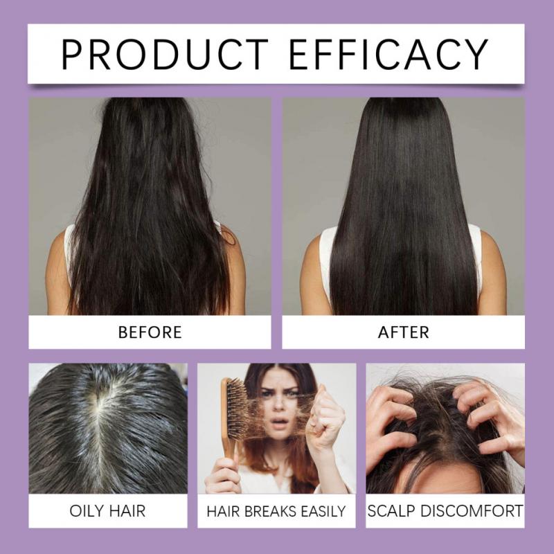 2 lahvičky Hoegoa Minoxidilová pěna